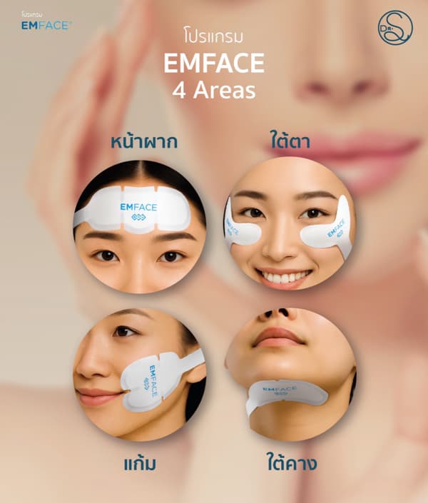 บริเวณที่ทำโปรแกรม EMFACE ได้ 4 จุด หน้าผาก ใต้ตา แก้ม และใต้คาง